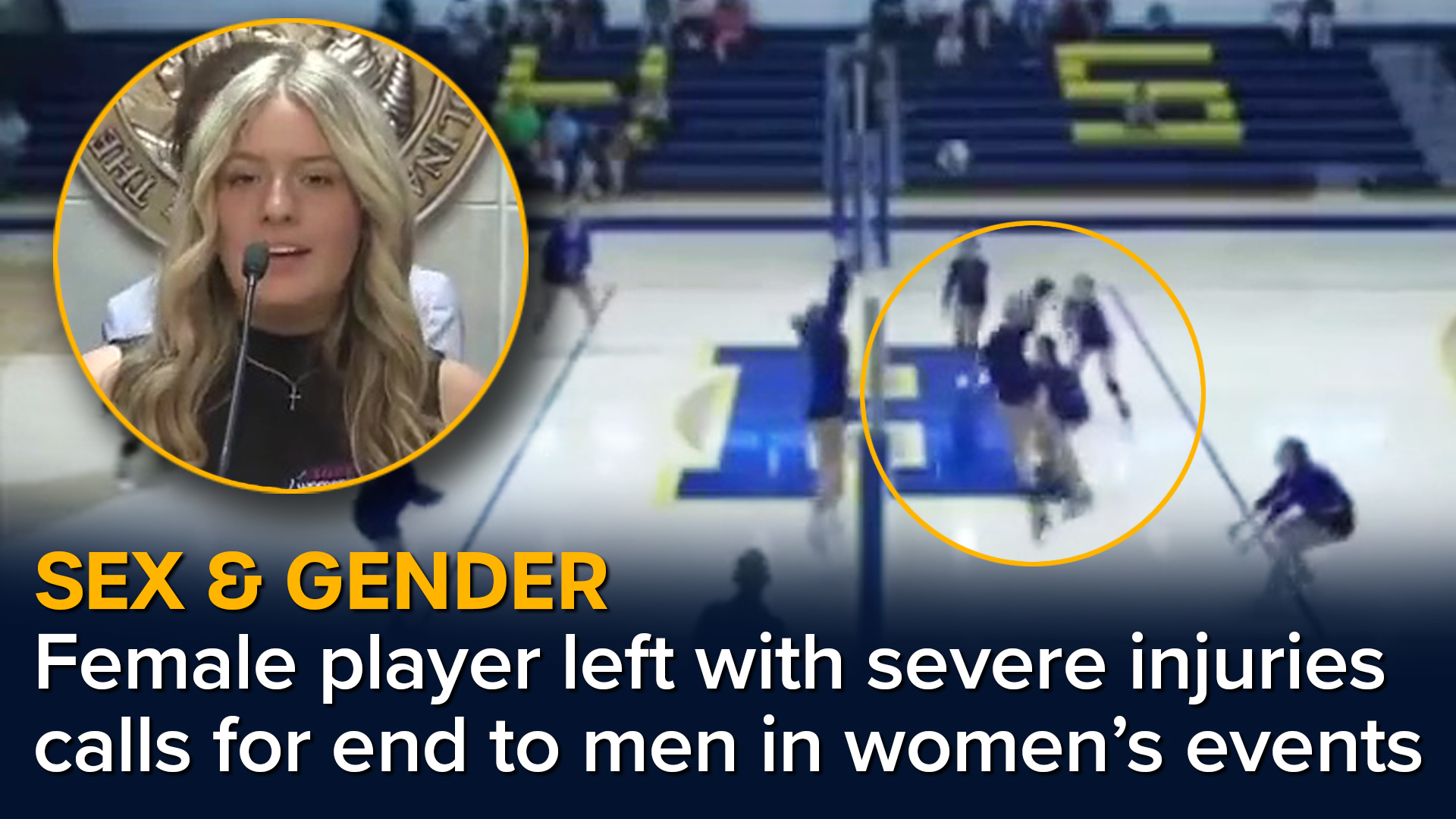 My life has changed forever' Volleyball student hit in the face by biological male